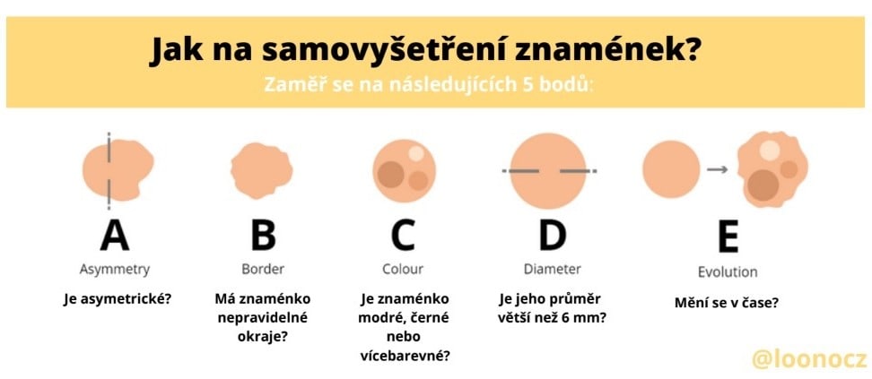 ABCDE pravidlo pro samovyšetření melanomu.